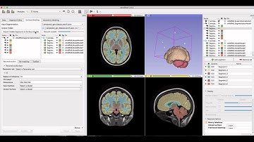 aevaSlicer: Using Labelmaps