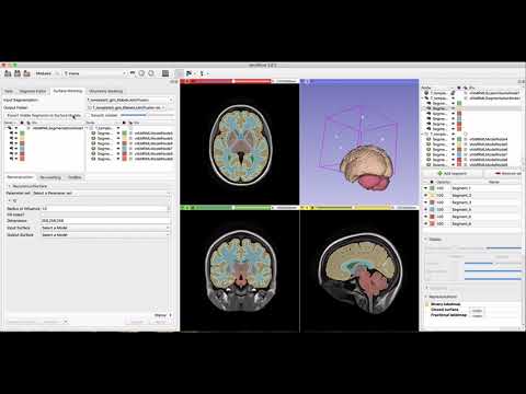 aevaSlicer: Using Labelmaps