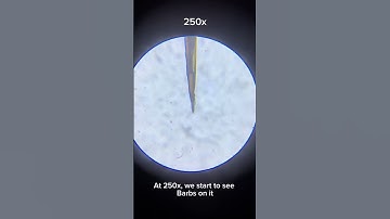 What a Bee Stinger Looks Like, and How it Works