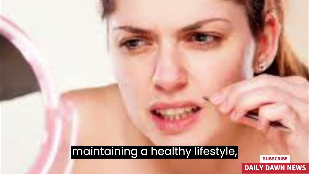 stopfacialhairgrowth-how-to-stop-facial-hair-growth-in-females