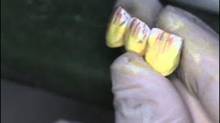 Pre-Sinterd Zirconia Coloring Advanced Technique
