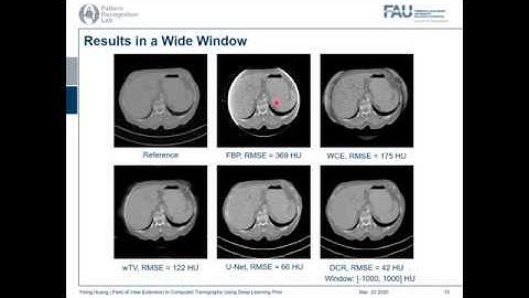 Field of View Extension in Computed Tomography Using Deep Learning Prior