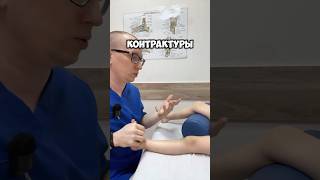 Из-за чего образуются контрактуры суставов? #контрактура #контрактурасустава