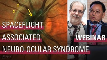 Ocular Changes in Space: Lessons from the International Space Station & Ground-Based Studies