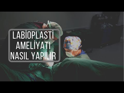 How to operate labioplasty surgery?