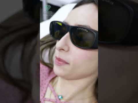 ليزر إزالة الشعر أجين من ديكا في مركز دياموند الطبي في عمان