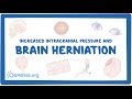 Brain herniation - causes, symptoms, diagnosis, treatment, pathology