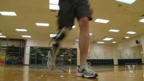 Popular Amputation & Leg videos