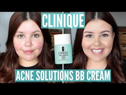 First | Clinique Acne Solutions Cream SPF 40 (Acne/Scarring) - YouTube