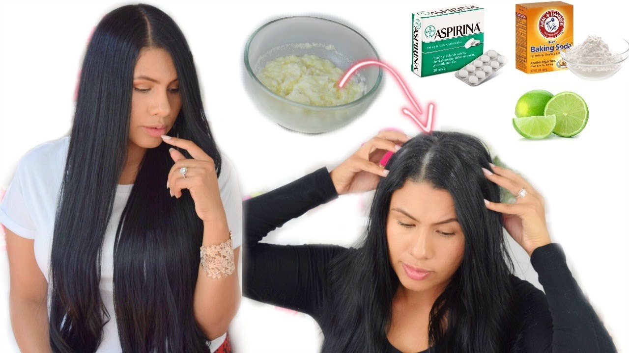 ELIMINA LA CASPA PARA EN 1 DIA 💆🏻 REMEDIO CASERO fashionbycarol 🌸 - YouTube