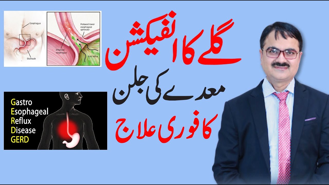 GERD Symptoms and Treatment Throat Infection & GERD Dr Tarique Ali