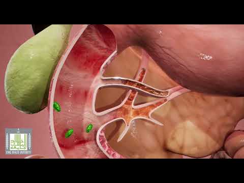 فيديو: ما هي القناة الهضمية المسؤولة عن التجزئة والتمعج؟