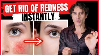 HOW TO GET RID OF REDNESS AND BLOOD VESSELS ON THE FACE