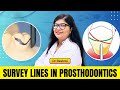 🦷 Survey Lines in Prosthodontics Explained | By Dr. Rashmi