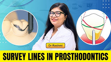 🦷 Survey Lines in Prosthodontics Explained | By Dr. Rashmi
