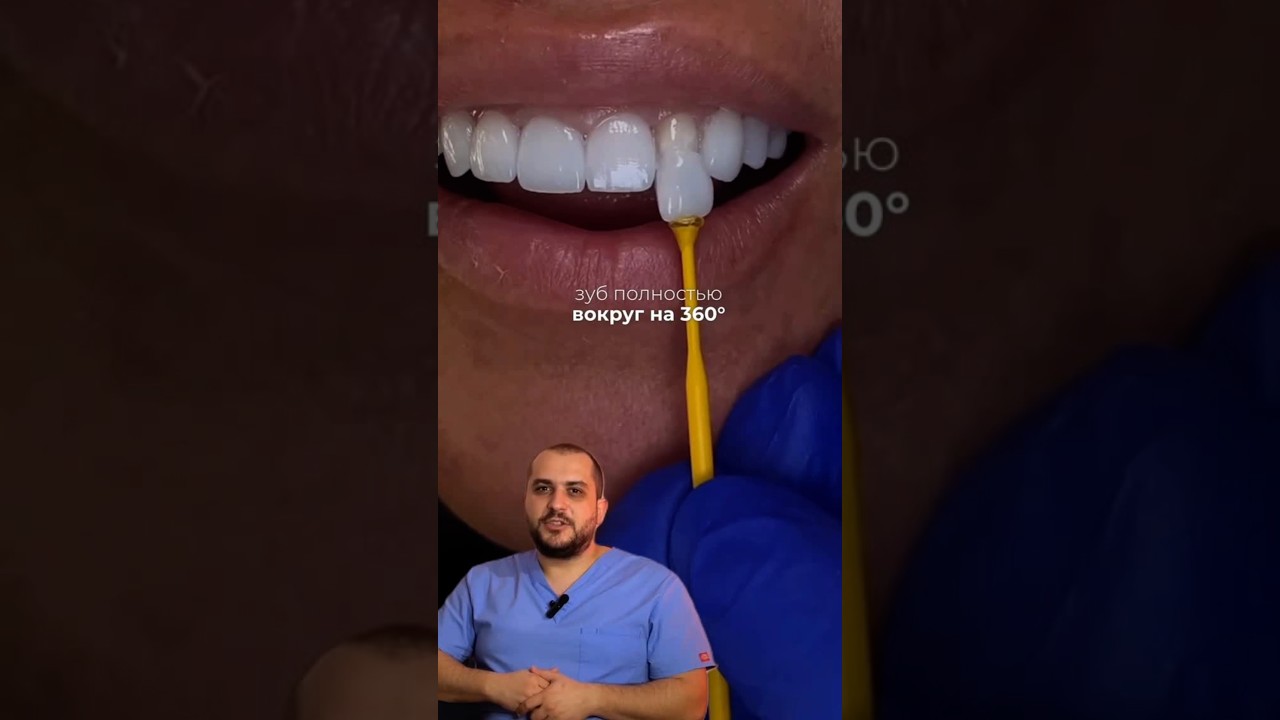 ЧЕМ ОТЛИЧАЕТСЯ КОРОНКА ОТ ВИНИРА? #стоматолог #dentist #доктор #зубы #виниры #коронка