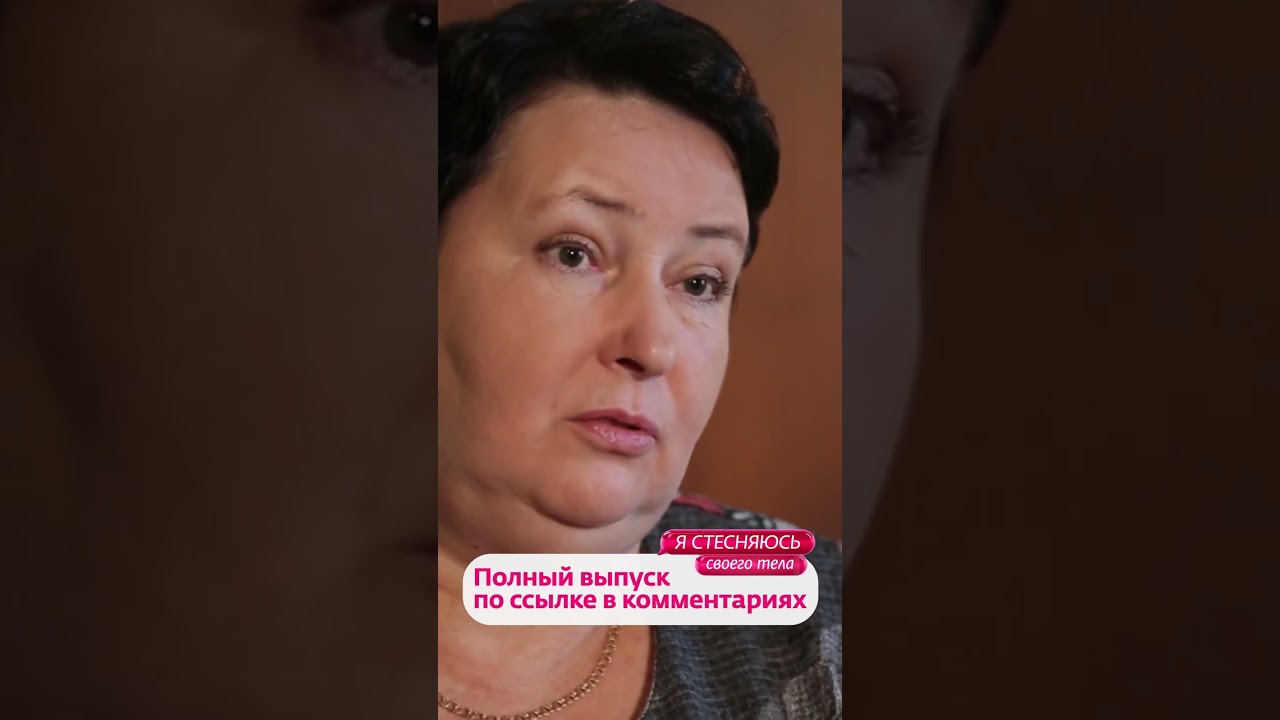 Чем опасны родимые пятна? | Я стесняюсь своего тела