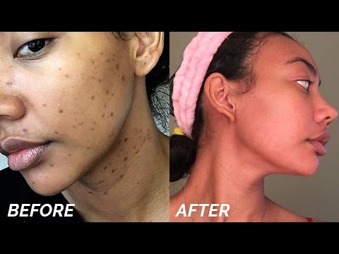 [REVIEW] PEEL OFF MASK GARNIER LIGHT COMPLETE || Fani Anindya. 
