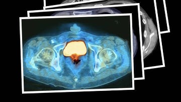 OsiriX stuff - the original.mov