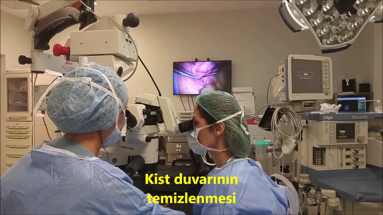 Goz Kapaginda Kist Ameliyati Youtube
