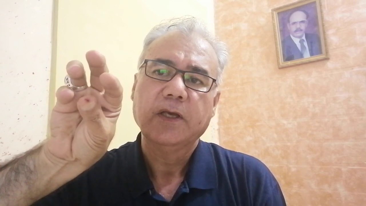 94:  العلاج الوحيد لتضيق فتحة الشرج!!!!