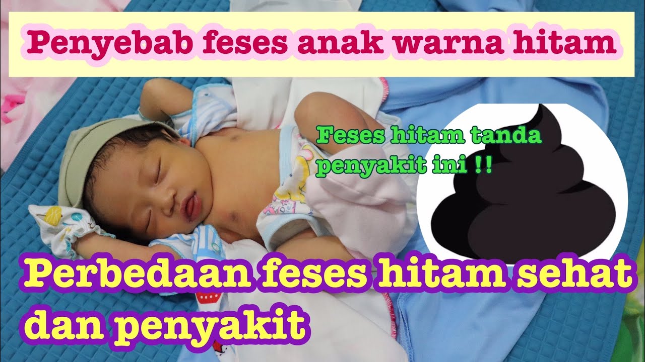 FESES ANAK WARNA HITAM. INI PENYEBAB UTAMANYA. TERNYATA ADA YANG NORMAL