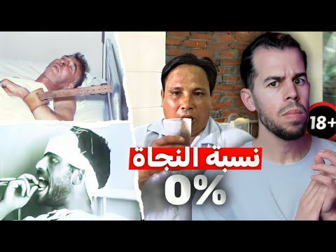 السعار أغرب مرض في تاريخ الطب