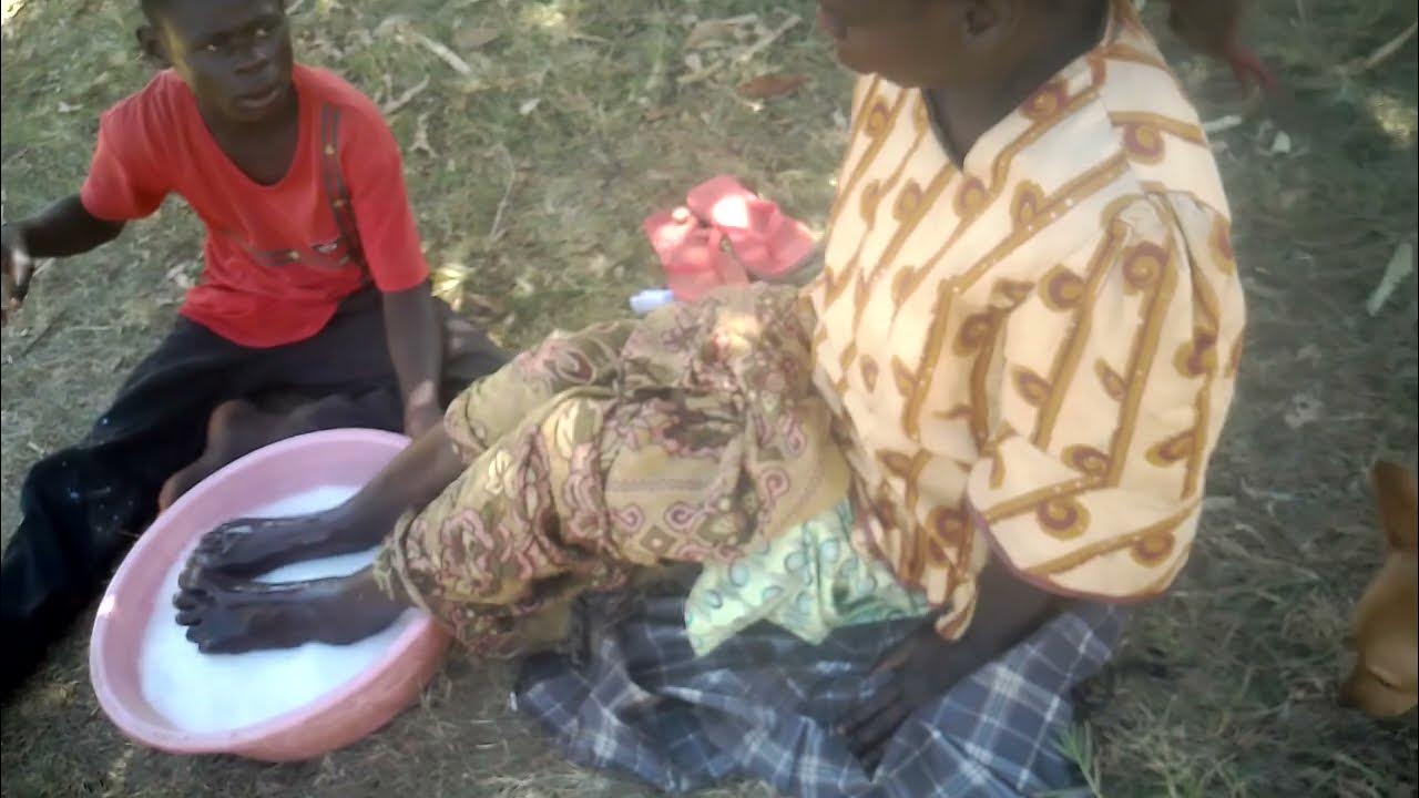 helping this family to treat jiggers 💯🌺🌺 everyone from mother to 3 kids