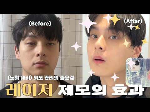 30대 남자 외모 관리 브이로그✨ | 건성 피부, 스킨 케어, 운동, 레이저 제모
