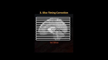 Milwaukee AFNI Workshop: Part 2: Preprocessing