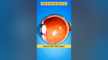 आँख का 3D ऑपरेशन 😱#3danimation #facts