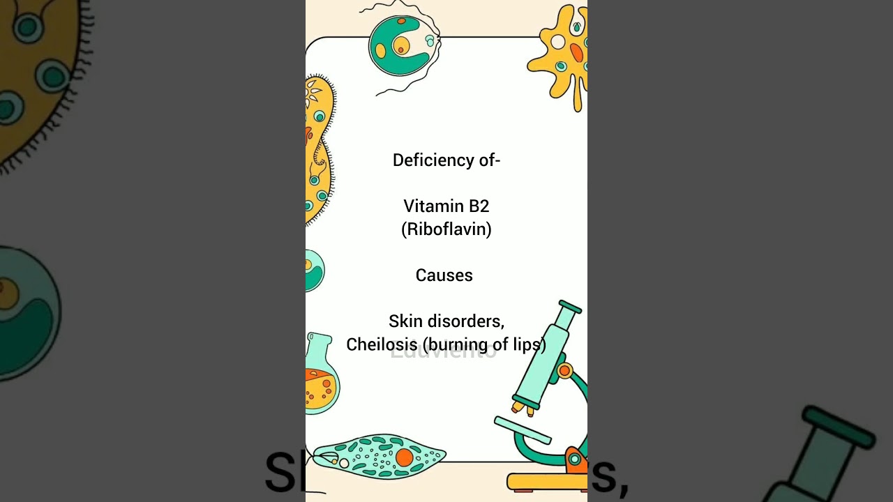 Which disease is caused due to deficiency of the vitamins 