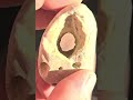 what do you say? holey stone, hag stone, fairy stone, witch stone, adder stone, friendship stone?🤔👁🪨