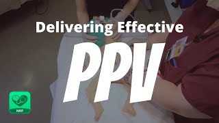 Delivering Effective PPV for Neonatal Resuscitation | NRP Mastery for Nurses by Nursing and NCLEX Mastery 27,694 views 1 year ago 1 minute, 11 seconds
