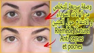 وصفة سريعة
للتخلص من الهالات السوداء
 و الانتفاخ حول العينين Rremède Naturel Anti cernes et poches