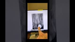 No Cbct. Brought Receipts