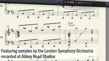 Notion 5 Feature Overview