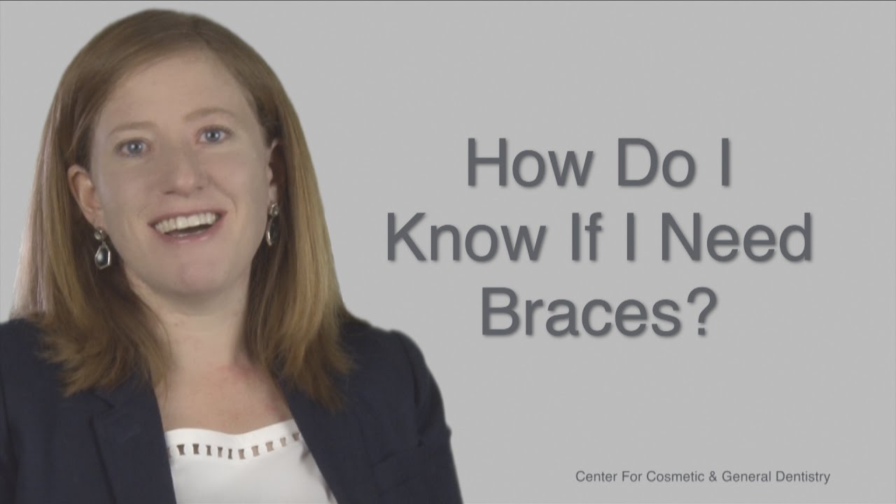 How To Know If U Need Braces