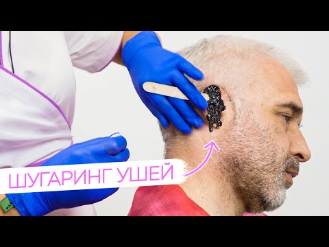 Шугаринг УШЕЙ мужчине | Мужская депиляция от Яны Осадчей