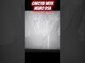Neuro and Carotid DSA #radiology #cathlab #angiography #angiogram #neurology #vascularsurgeon