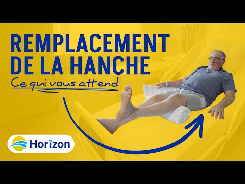 Vidéo: Remplacement De La Hanche Antérieure: Avantages, Risques, Perspectives Et à Quoi S'attendre