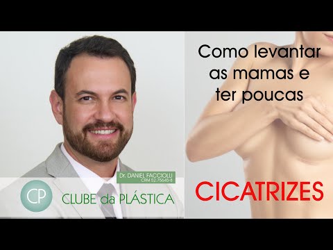 Clube da Plástica: Como levantar as mamas e ter poucas cicatrizes