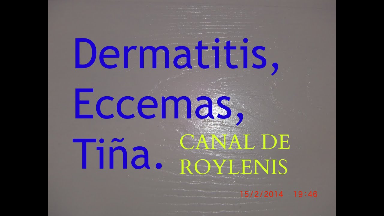 major field of study medicine Dermatitis, Eccemas, Tiña: SÁBILA.