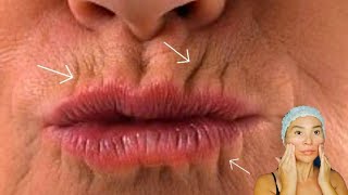 5 ways to GET RID of LIP WRINKLES | Lift up lip corners | Smokers lines