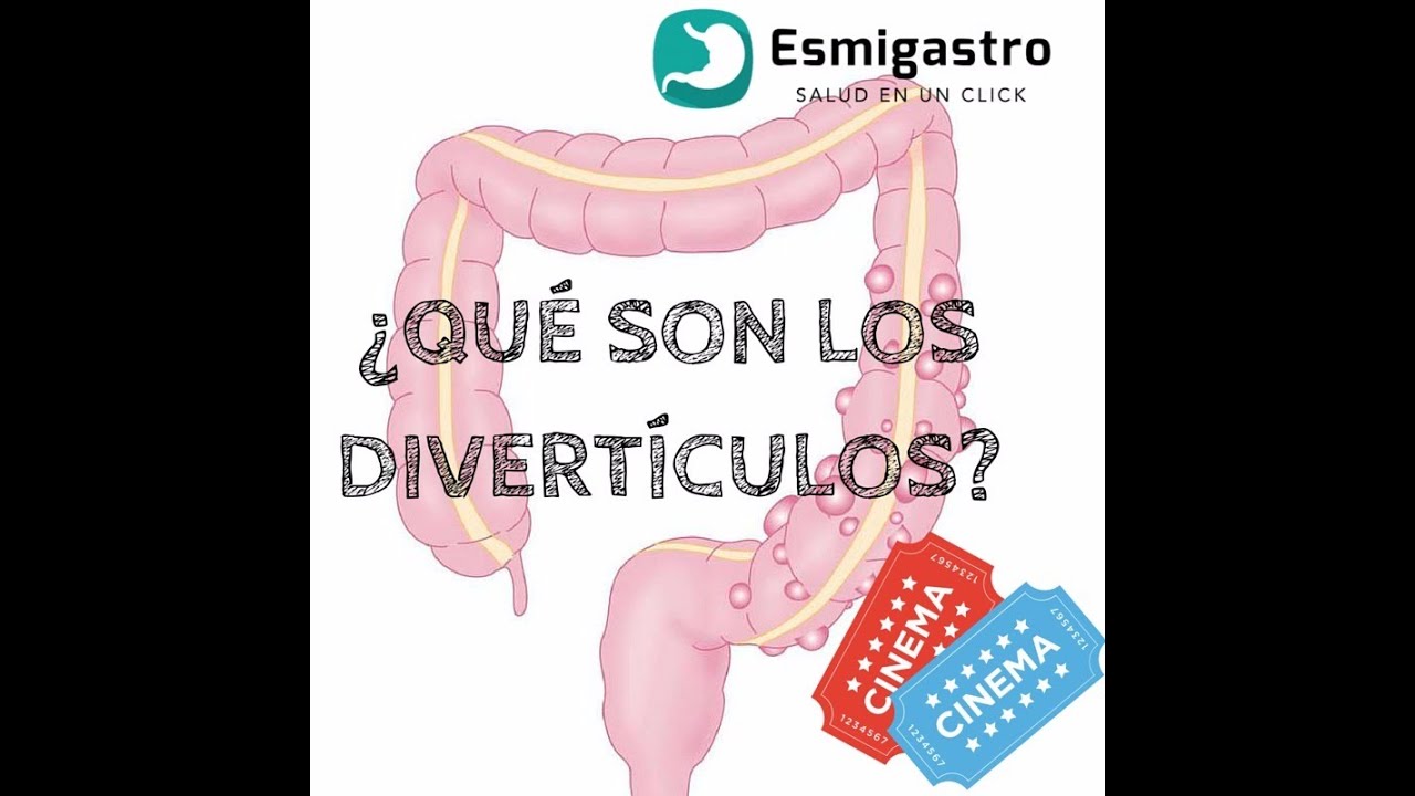 Diverticulos saludos amigos dvd