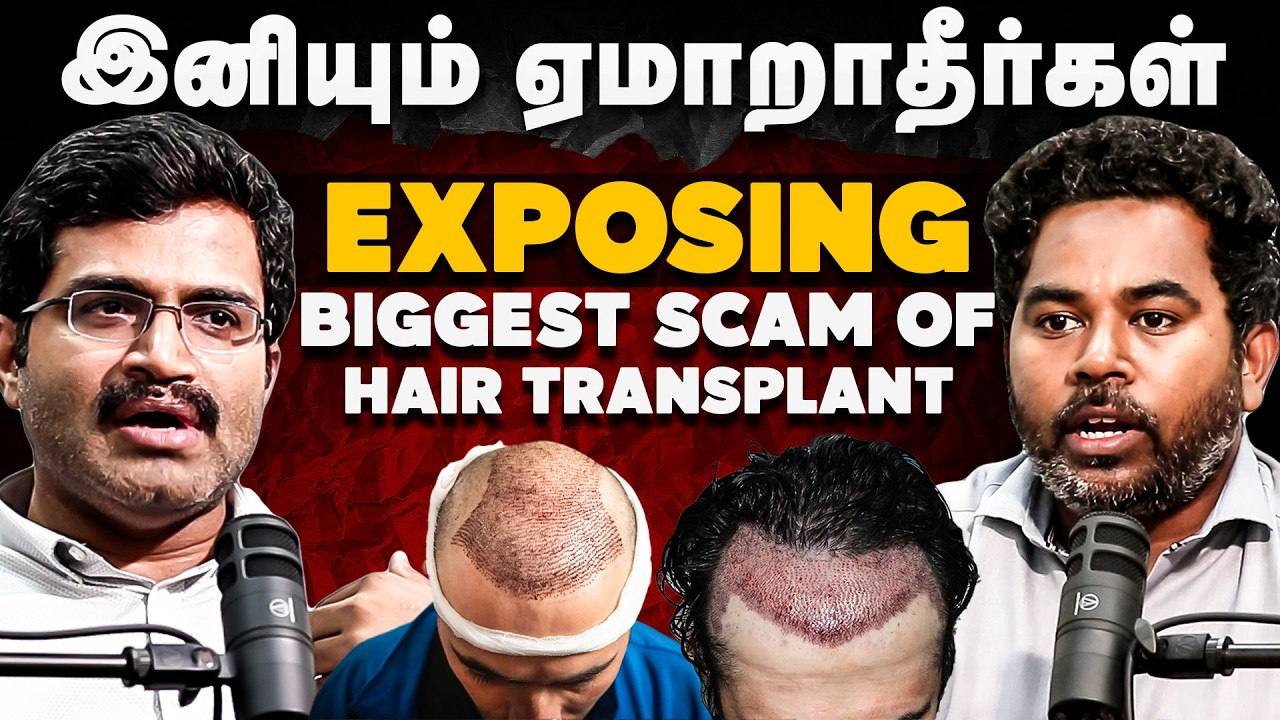 HAIR TREATMENT SCAM | இனியும் ஏமாறாதீர்கள் | EXPOSING BIGGEST SCAM OF HAIR TRANSPLANT | Cover Story