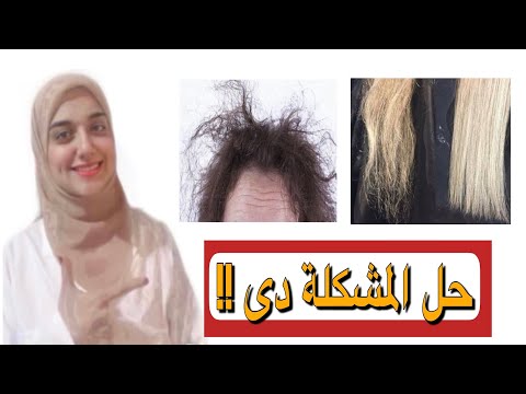 فيديو: 3 طرق لوقف التقصف والأضرار التي تلحق بالشعر الأفريقي