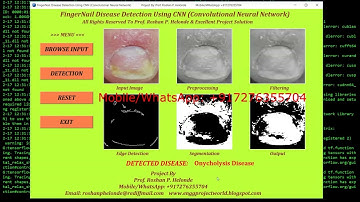 Python Code On FingerNail Disease Detection Using CNN Full Python Source Code #SourceCode