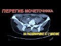ДИФФУЗНЫЕ ИЗМЕНЕНИЯ паренхимы поджелудочной железы и ПЕРЕГИБ МОЧЕТОЧНИКА на расшифровке КТ 2 МНЕНИЕ