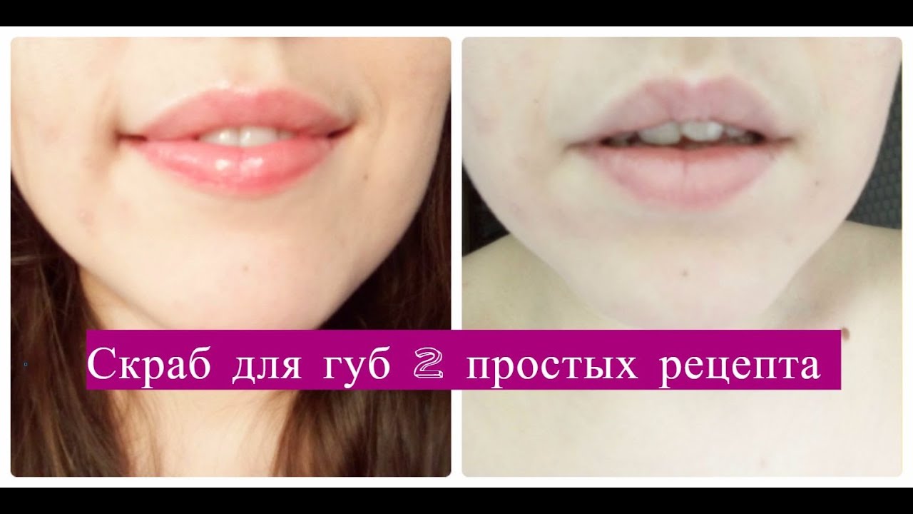 Видео-рецепт скраба для губ Видео-рецепт скраба для губ